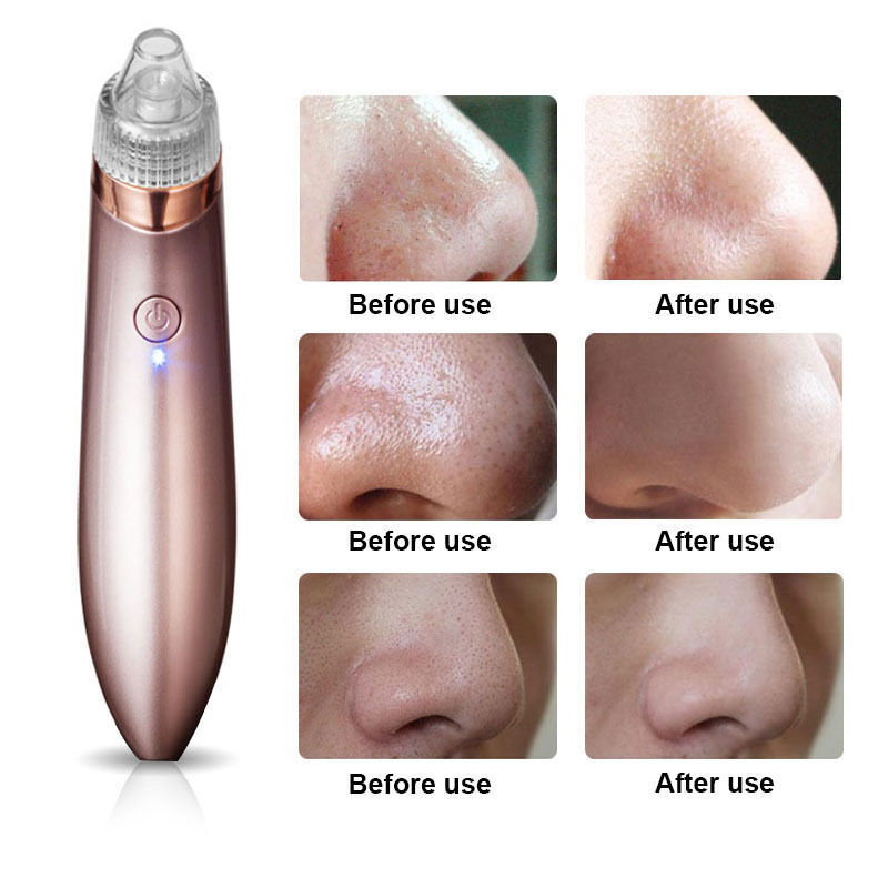 Electric Facial Skin Care Pore Blackhead Cleaner Remover Vacuum Acne Cleanser