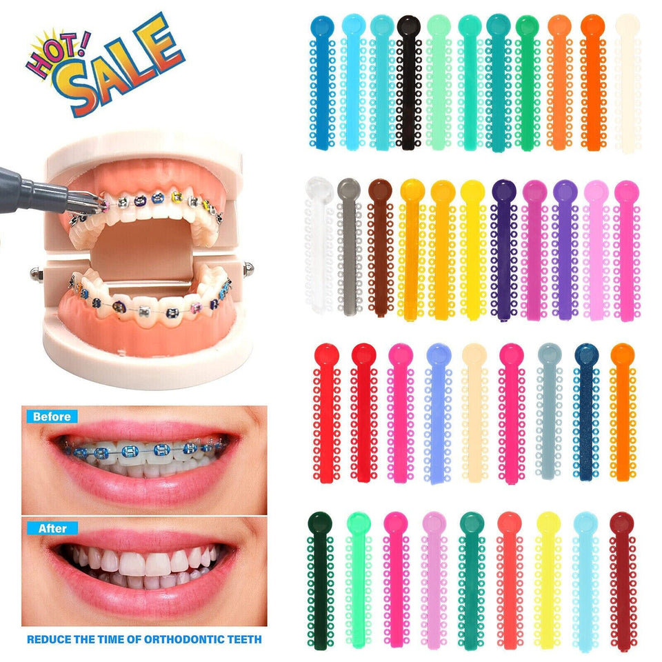 1040pcs Dental Orthodontic Ligature Ties Braces Elastic Rubber Bands Mixed Color