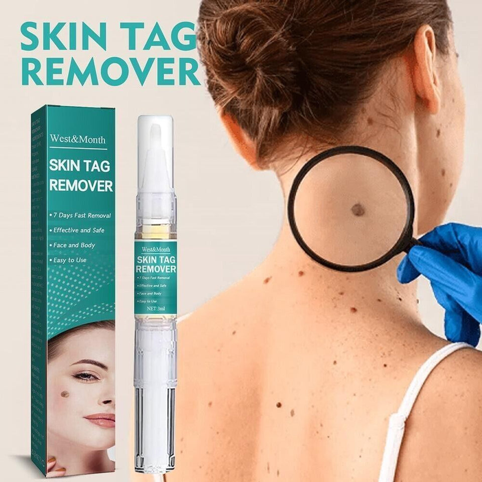 5-Pack Painless Wart Remover Pen Eliminate Skin Tag Foot Corn Mole Restoration