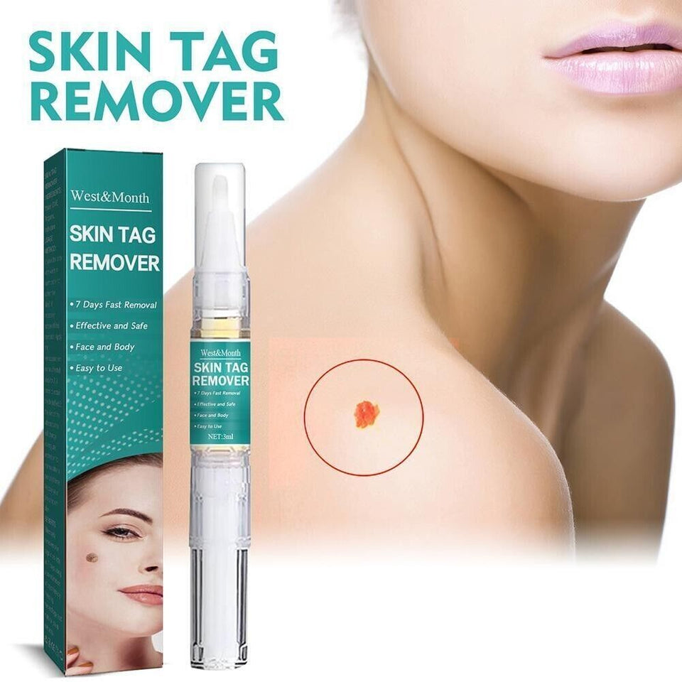 5-Pack Painless Wart Remover Pen Eliminate Skin Tag Foot Corn Mole Restoration