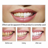 Teeth Whitening Essence Serum Plaque Stains Remove Cleaning Liquid Oral Care