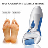 Pro Pedicure Kit Pedi Foot File Hard Dead Skin Electrical Care Callus Remover