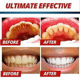 Intensive Stain Removal Teeth Whitening Toothpaste Fight Bleeding Gums Blueberry