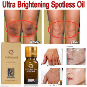 Ultra Brightening Spotless Oil Anti Dark Spots Natural Pure Oil Skin Care 30ml